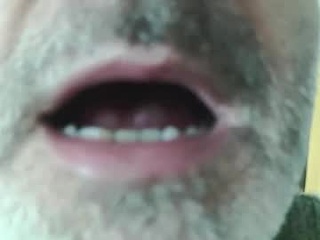 edal1