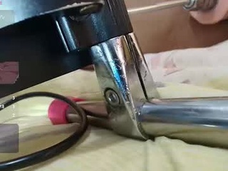 mrs_anal